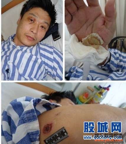 打死才赔30万